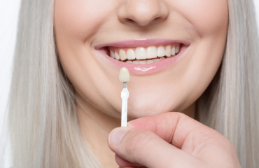 Dental veneers, as part of many available smile solutions, can transform