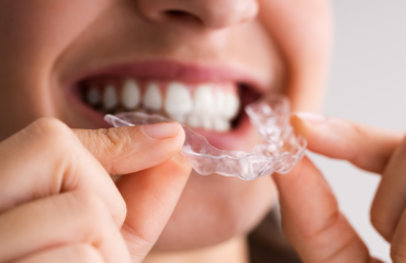 Explore the journey to a perfect smile with clear aligners, from maintenance to cost factors. Let Grange Family Dental guide your transformation