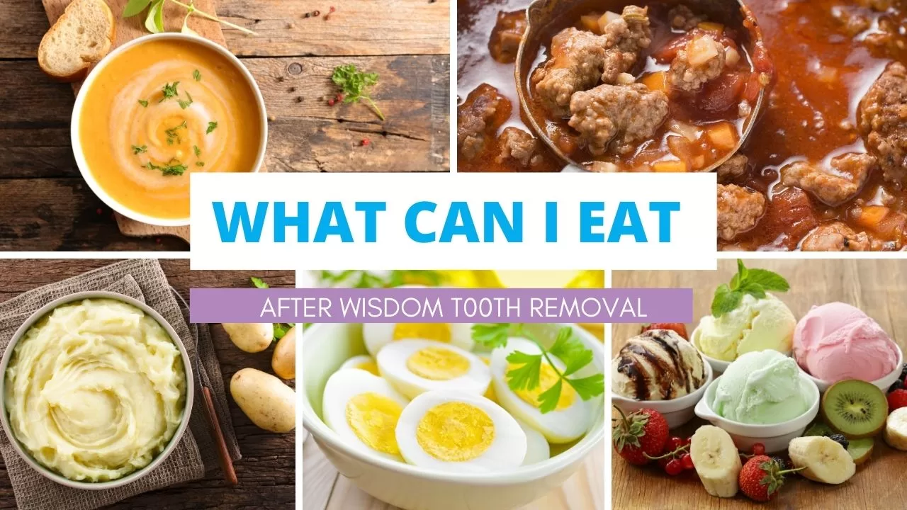 what to eat after wisdom teeth removal