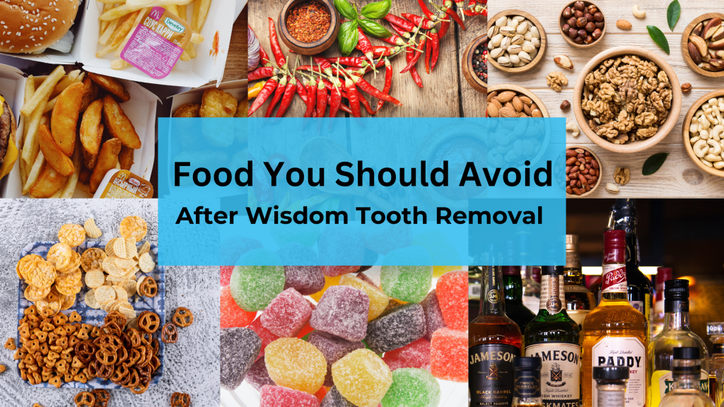 Remember, avoiding certain foods after wisdom tooth removal speeds up recovery and prevents complications